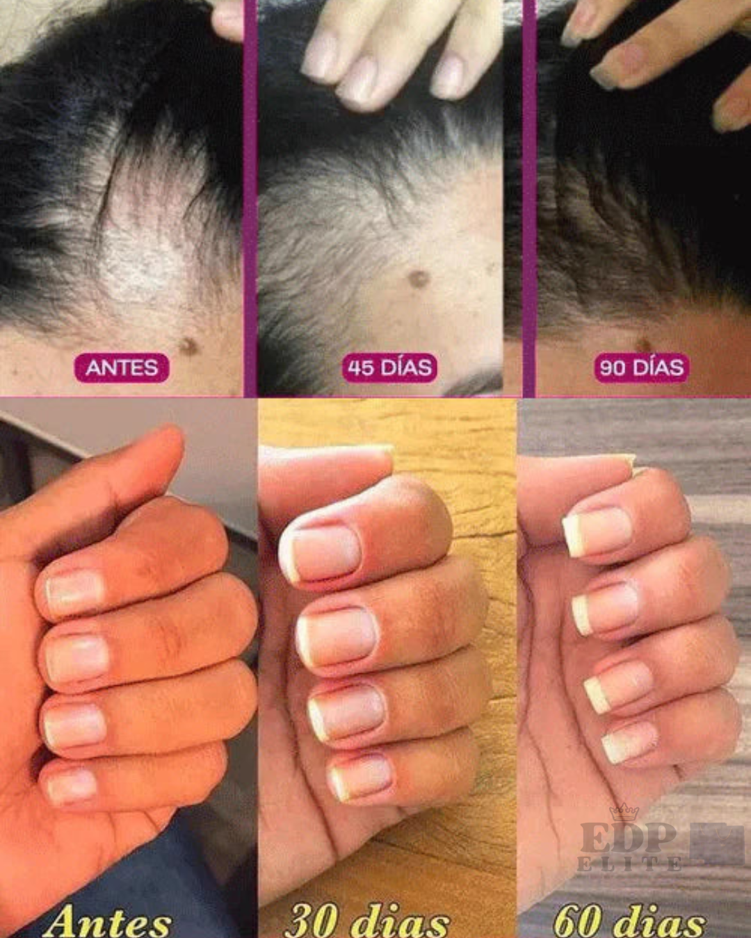 RENÖVA+ | Colágeno con Biopéptidos Activos + 21 Vitaminas
